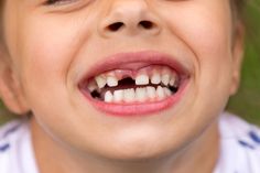 time kids' teeth take to grow back